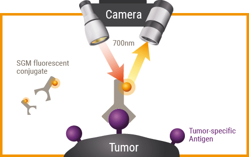 Immunophotodetection tumor5