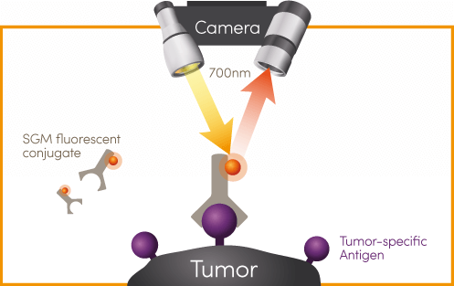 Intraoperative detection of tumors